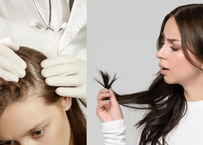 Hairfall Treatment